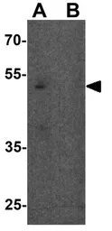 Anti-SLC1A7 antibody used in Western Blot (WB). GTX32146