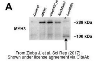 Anti-MYH3 antibody used in Western Blot (WB). GTX32147
