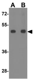 Anti-SLC29A3 antibody used in Western Blot (WB). GTX32151