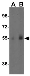 Anti-MKRN3 antibody used in Western Blot (WB). GTX32153