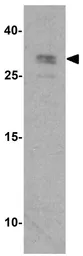 Anti-RSPO3 antibody used in Western Blot (WB). GTX32155