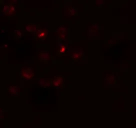 Anti-RSPO3 antibody used in Immunocytochemistry/ Immunofluorescence (ICC/IF). GTX32155