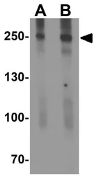 Anti-C2CD3 antibody used in Western Blot (WB). GTX32156