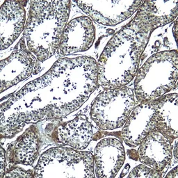 Anti-ADAM29 antibody used in IHC (Paraffin sections) (IHC-P). GTX32157