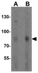 Anti-ADAM29 antibody used in Western Blot (WB). GTX32157