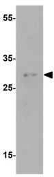 Anti-ULBP4 antibody used in Western Blot (WB). GTX32159
