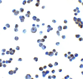 Anti-ULBP4 antibody used in Immunocytochemistry/ Immunofluorescence (ICC/IF). GTX32159