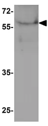Anti-PALMD antibody used in Western Blot (WB). GTX32160