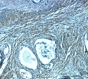 Anti-PMEPA1 antibody used in IHC (Paraffin sections) (IHC-P). GTX32162