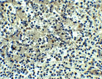 Anti-DEPDC1B antibody used in IHC (Paraffin sections) (IHC-P). GTX32163