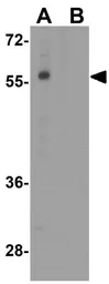 Anti-DEPDC1B antibody used in Western Blot (WB). GTX32163