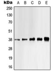 Anti-Casein Kinase 1 alpha (phospho Tyr321) antibody used in Western Blot (WB). GTX32170