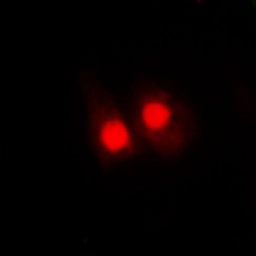 Anti-FANCA (phospho Ser1149) antibody used in Immunocytochemistry/ Immunofluorescence (ICC/IF). GTX32179