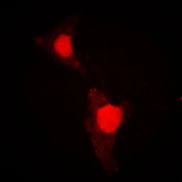 Anti-FOXO1 (phospho Ser319) antibody used in Immunocytochemistry/ Immunofluorescence (ICC/IF). GTX32183