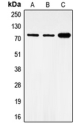 Anti-FOXO1 (phospho Ser319) antibody used in Western Blot (WB). GTX32183