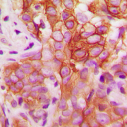 Anti-FYN (phospho Tyr530) antibody used in IHC (Paraffin sections) (IHC-P). GTX32185