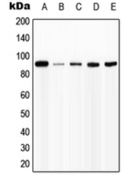 Anti-Interferon gamma Receptor 1 (phospho Tyr457) antibody used in Western Blot (WB). GTX32197