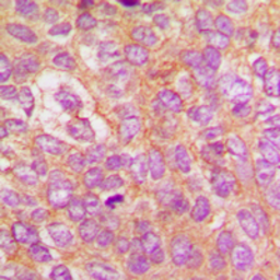 Anti-IKK beta (phospho Tyr188) antibody used in IHC (Paraffin sections) (IHC-P). GTX32199