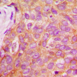 Anti-IRS1 (phospho Ser1101) antibody used in IHC (Paraffin sections) (IHC-P). GTX32201