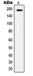 Anti-IRS1 (phospho Ser1101) antibody used in Western Blot (WB). GTX32201