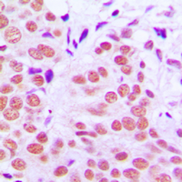 Anti-c-Jun (phospho Thr91) antibody used in IHC (Paraffin sections) (IHC-P). GTX32204