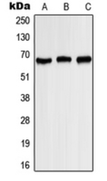 Anti-Kv1.3 (phospho Tyr187) antibody used in Western Blot (WB). GTX32206