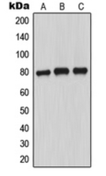 Anti-MARCKS (phospho Ser156) antibody used in Western Blot (WB). GTX32212