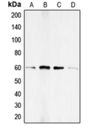 Anti-Smad1 (phospho Ser187) antibody used in Western Blot (WB). GTX32213