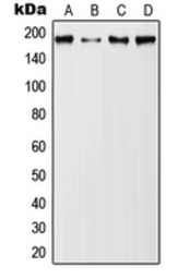 Anti-MUC1 (phospho Tyr1229) antibody used in Western Blot (WB). GTX32218