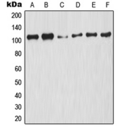 Anti-NFkB p105 (phospho Ser927) antibody used in Western Blot (WB). GTX32222