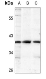 Anti-IKB alpha (phospho Ser32/Ser36) antibody used in Western Blot (WB). GTX32224