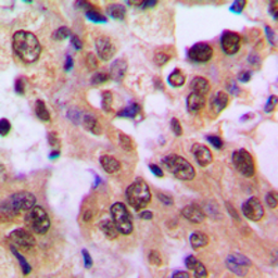 Anti-IKB beta (phospho Ser23) antibody used in IHC (Paraffin sections) (IHC-P). GTX32225