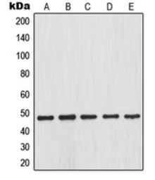 Anti-IKB beta (phospho Ser23) antibody used in Western Blot (WB). GTX32225