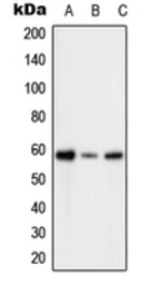 Anti-PFKFB2 (phospho Ser483) antibody used in Western Blot (WB). GTX32234