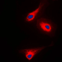 Anti-PLCG1 (phospho Tyr1253) antibody used in Immunocytochemistry/ Immunofluorescence (ICC/IF). GTX32238