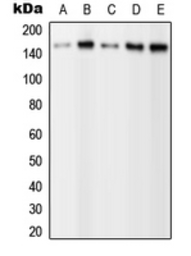 Anti-PLCG2 (phospho Tyr1217) antibody used in Western Blot (WB). GTX32239