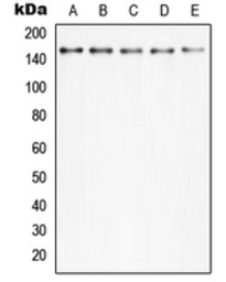 Anti-PLCG2 (phospho Tyr753) antibody used in Western Blot (WB). GTX32240