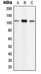 Anti-Phospholipase D2 (phospho Tyr169) antibody used in Western Blot (WB). GTX32241