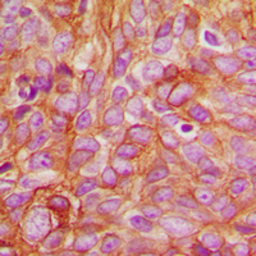 Anti-PKC delta (phospho Thr507) antibody used in IHC (Paraffin sections) (IHC-P). GTX32244
