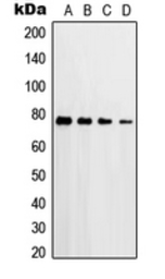 Anti-PKC delta (phospho Thr507) antibody used in Western Blot (WB). GTX32244