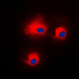Anti-PKC theta (phospho Ser676) antibody used in Immunocytochemistry/ Immunofluorescence (ICC/IF). GTX32246