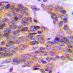 Anti-PKC theta (phospho Ser676) antibody used in IHC (Paraffin sections) (IHC-P). GTX32246