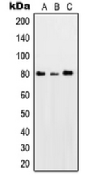 Anti-PKC theta (phospho Ser676) antibody used in Western Blot (WB). GTX32246