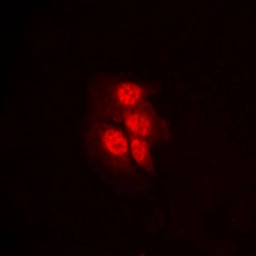 Anti-MEK1 (phospho Thr292) antibody used in Immunocytochemistry/ Immunofluorescence (ICC/IF). GTX32249