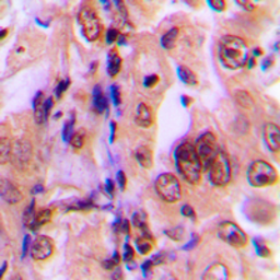 Anti-MEK1 (phospho Thr292) antibody used in IHC (Paraffin sections) (IHC-P). GTX32249