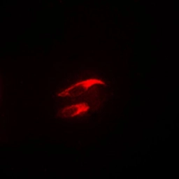 Anti-FAK (phospho Tyr925) antibody used in Immunocytochemistry/ Immunofluorescence (ICC/IF). GTX32252