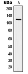 Anti-FAK (phospho Tyr925) antibody used in Western Blot (WB). GTX32252