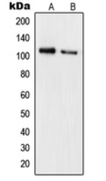Anti-Rb (phospho Ser780) antibody used in Western Blot (WB). GTX32254
