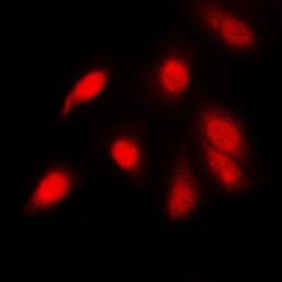 Anti-NFkB p65 (phospho Ser311) antibody used in Immunocytochemistry/ Immunofluorescence (ICC/IF). GTX32255