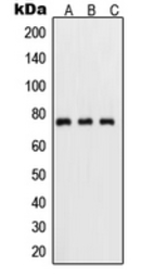 Anti-NFkB p65 (phospho Ser311) antibody used in Western Blot (WB). GTX32255